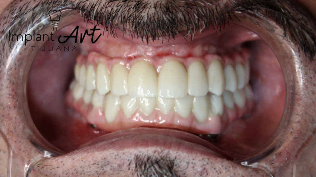 DENTES BONITOS
